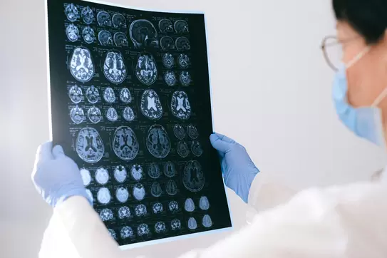 doctor reading brain scan